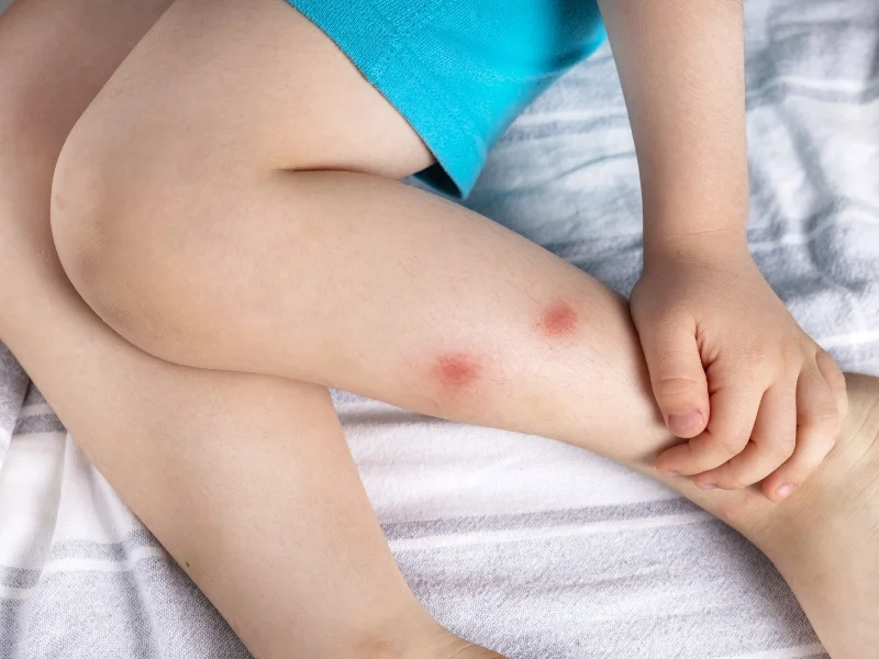 Ministry of Environmental Protection and Ministry of Health Update on the Capture of Mosquitoes Infected with West Nile Virus in Ramla the Gilboa Regional Council