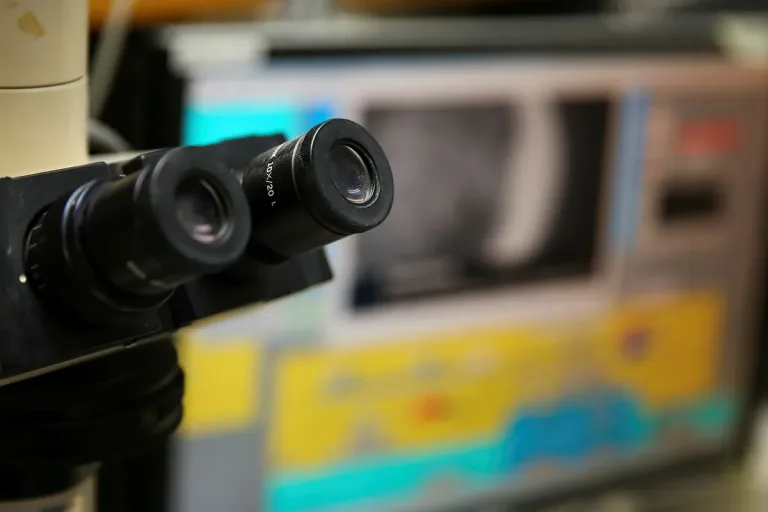 Hebrew University Researchers Discover How E. coli Outsmarts Human Cells