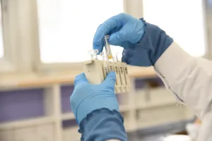 New Stool Test May Make Painful Colonoscopies Less Necessary
