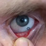 Injured Border Police Officer Returns to Training With Custom Prosthetic Eye